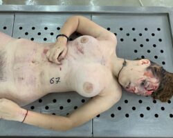 Naked dead girl in morgue