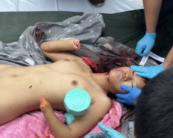 Slashed thai woman