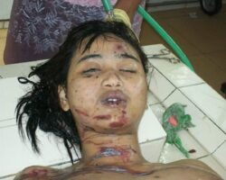 Asian woman in morgue after car crash
