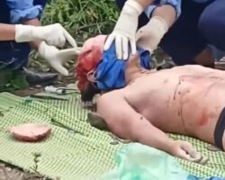 Outdoor autopsy on man